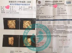 40岁高龄渴求儿女双全 深圳孕宝国际三代试管圆“凑好“之