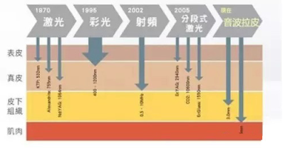 什么是Antisonic 超声刀?