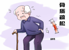 人到中老年容易骨质疏松