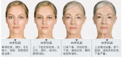 上海静和抗衰超声炮，真